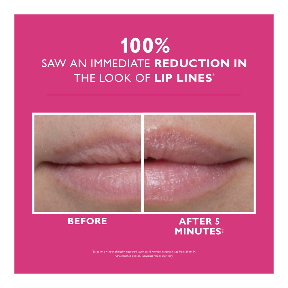 Instant Firmx® Lip Filler - 10ml