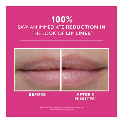 Instant Firmx® Lip Filler - 10ml