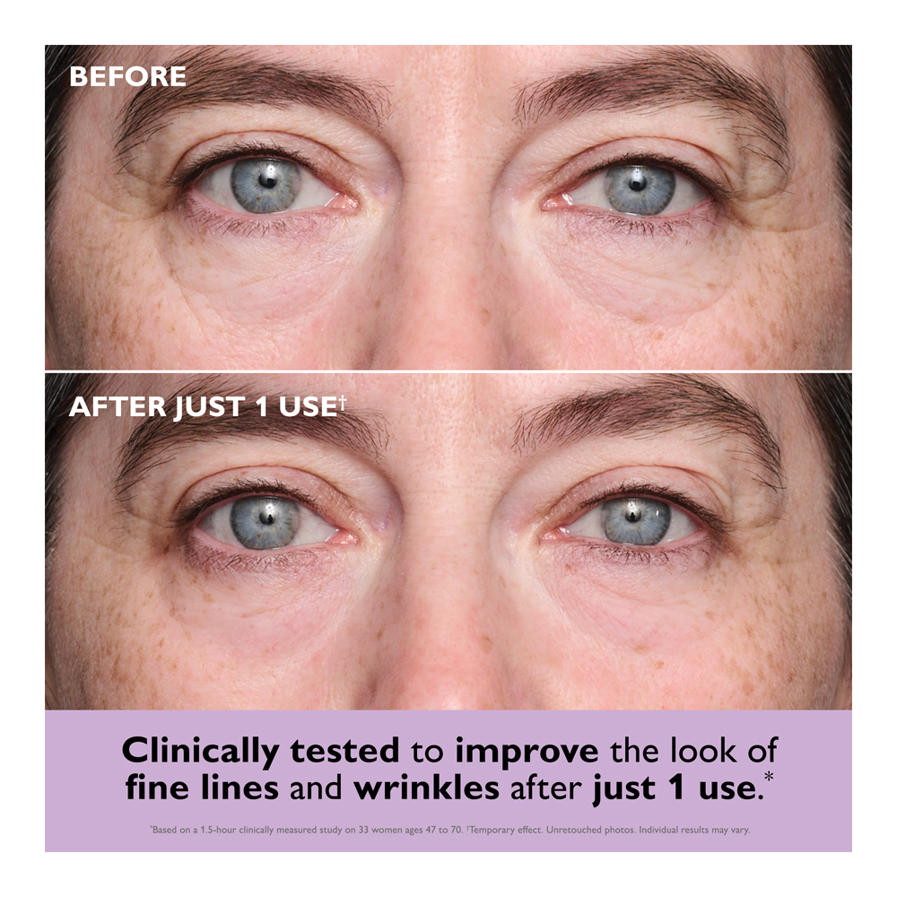 Instant FIRMx® Collagen Infusion Tightening Eye Patches - 20ml