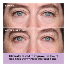 Instant FIRMx® Collagen Infusion Tightening Eye Patches - 20ml