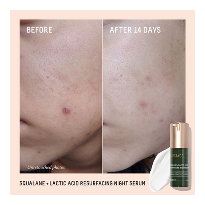 Squalane + 10% Lactic Acid Resurfacing Serum - 30ml