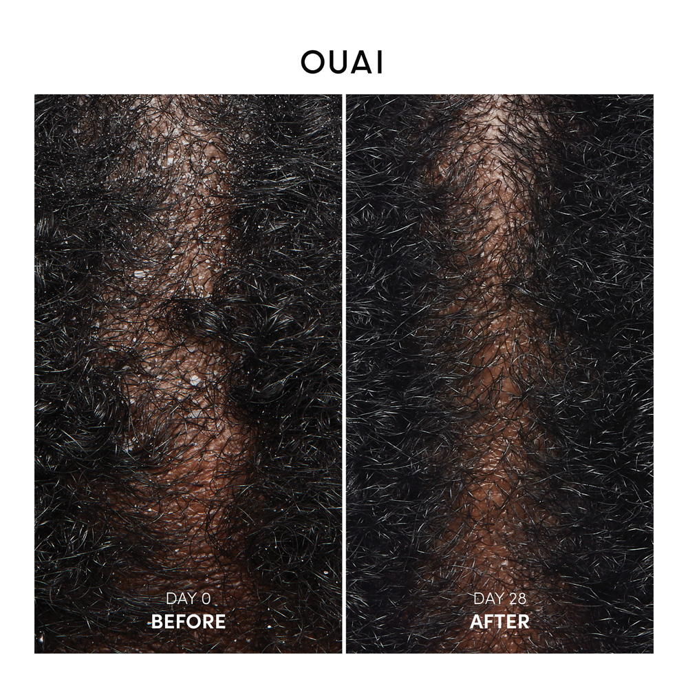 Anti Dandruff Shampoo - 300ml
