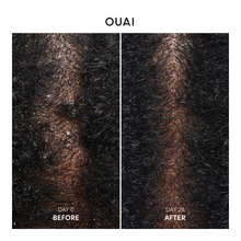 Anti Dandruff Shampoo - 300ml