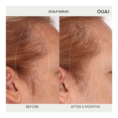 Scalp Serum - 60ml