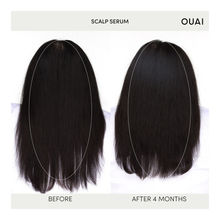Scalp Serum - 60ml