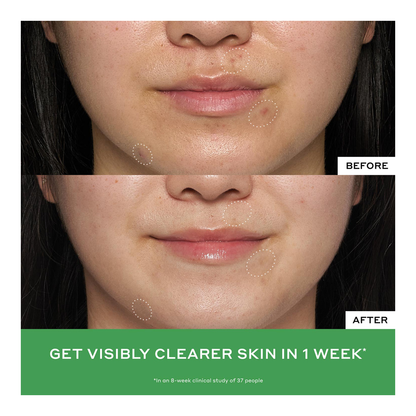 Detox Drops 2% Salicylic Acid Anti-Blemish Toner - 120ml