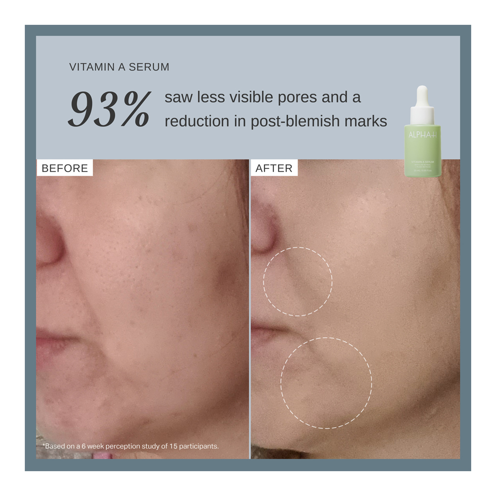 Vitamin A Serum With 0.3% Retinol - 25ml