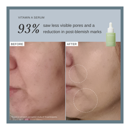 Vitamin A Serum With 0.3% Retinol - 25ml