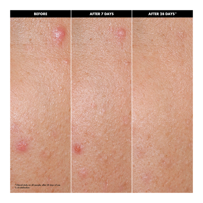 Clear & Purify Skin Serum - 30ml