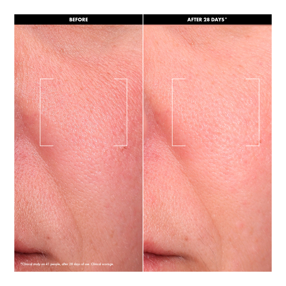 All About Glow Duo (Holiday Limited Edition)