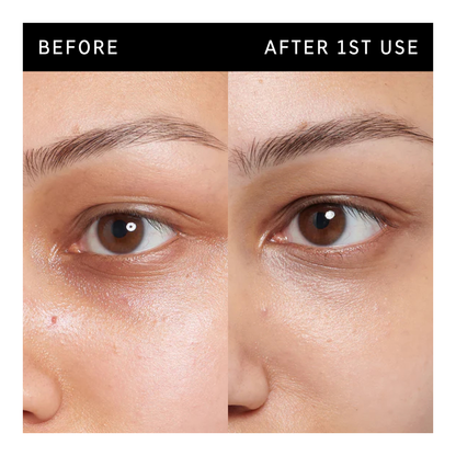 Caffeine Under-Eye Cream - 15ml