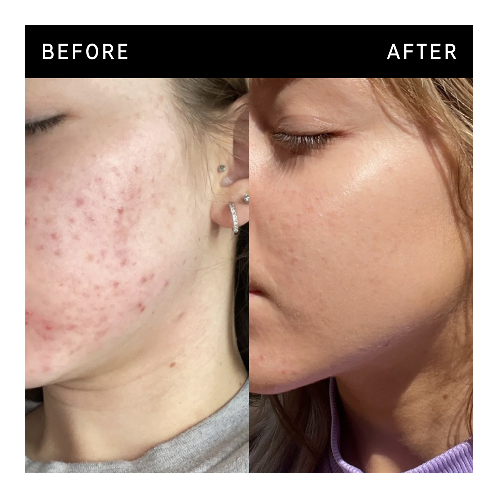 Niacinamide Face Serum - 30ml
