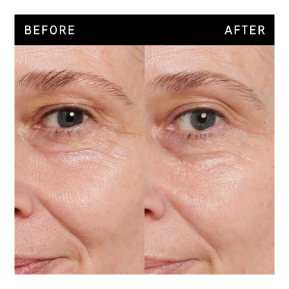 Retinol Eye Cream - 15ml