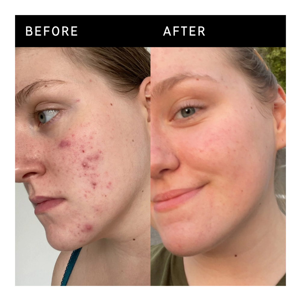 15% Vitamin C and EGF Brightening Serum - 30 ML