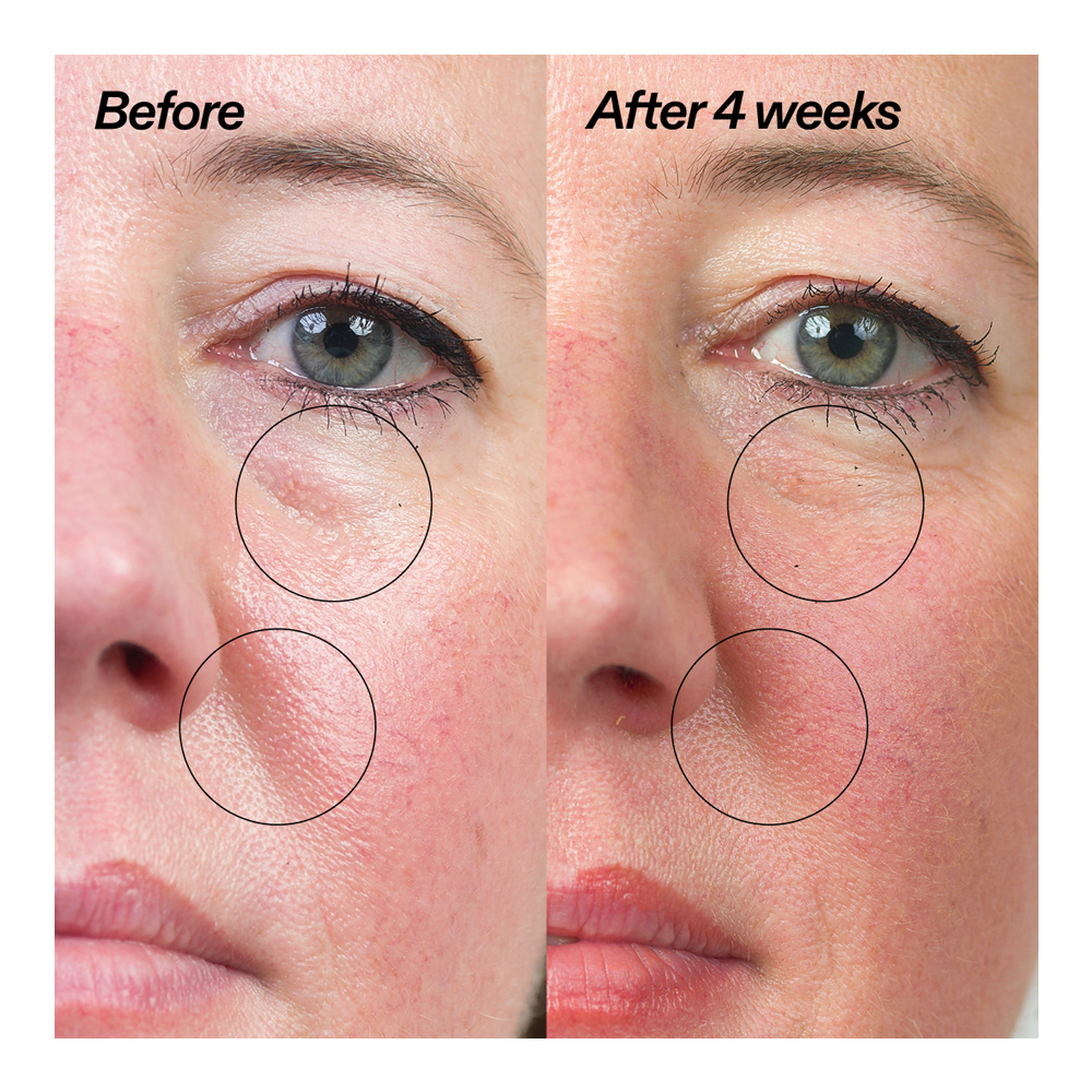 Bio-Active Ceramide Repairing And Plumping Moisturizer - 50ml