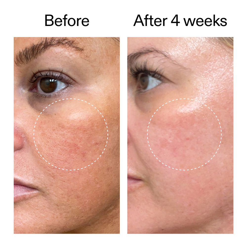 Starter Retinol Serum - 30ml