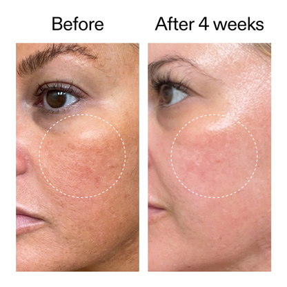 Starter Retinol Serum - 30ml