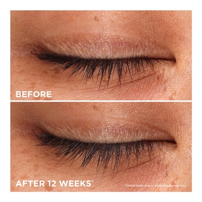 Whoop Lash Serum - 2ml
