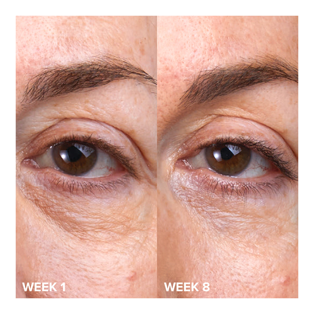 C5 Super Boost Eye Cream - 15ml