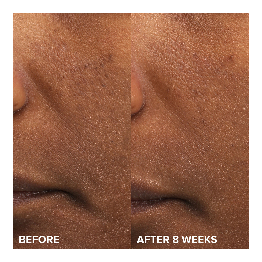 Skin Perfecting 6% Mandelic + 2% Lactic Acid Liquid Exfoliant - 88ml