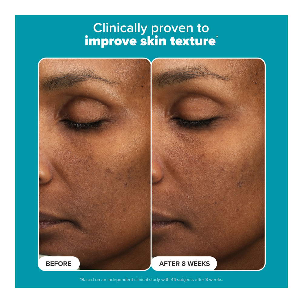 Skin Perfecting 6% Mandelic + 2% Lactic Acid Liquid Exfoliant - 88ml