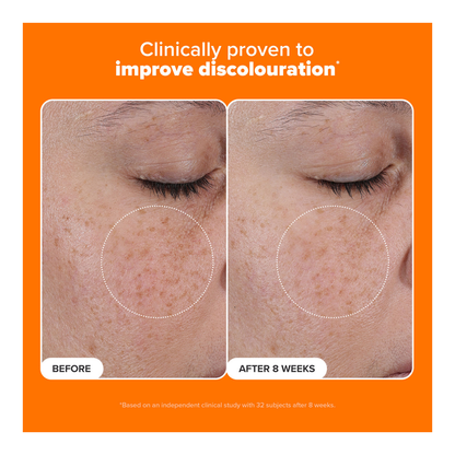 25% Vitamin C + Glutathione Clinical Serum - 30ml