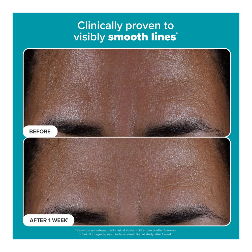 2% BHA Liquid Exfoliant - 118ml