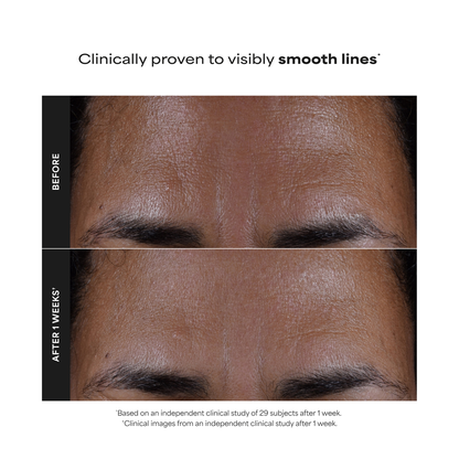 Skin Perfecting 2% BHA Liquid Exfoliant - 118ml