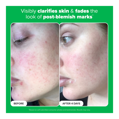 10% Azelaic Acid Booster - 30ml