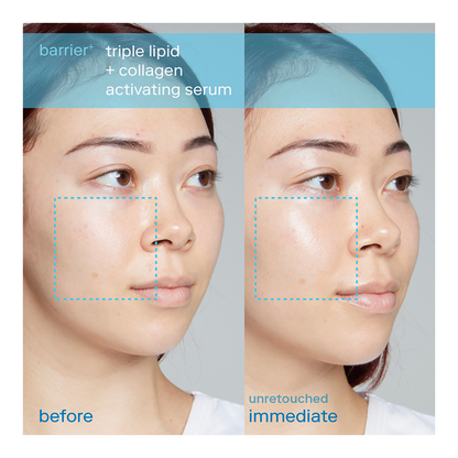 Triple Lipid + Collagen Activating Serum - 30ml