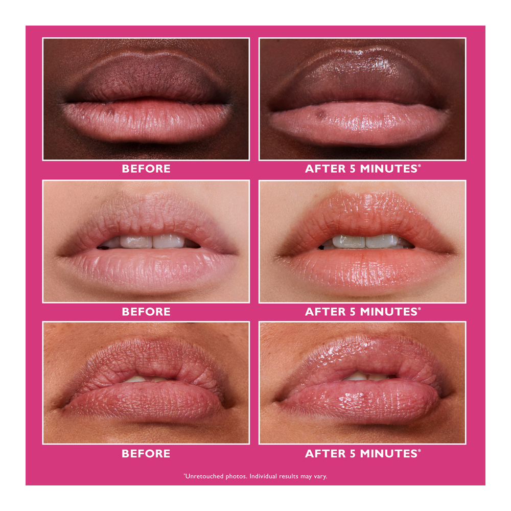 Instant Firmx® Lip Filler - 10ml