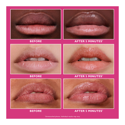 Instant Firmx® Lip Filler - 10ml