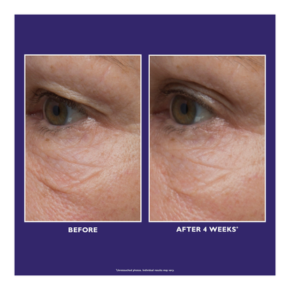 Clinical Skin Care Ultimate Solution 5™ Multitasking Eye Cream - 15ml