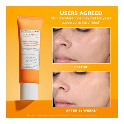 Potent-C™ Niacinamide Discoloration Treatment - 50ml