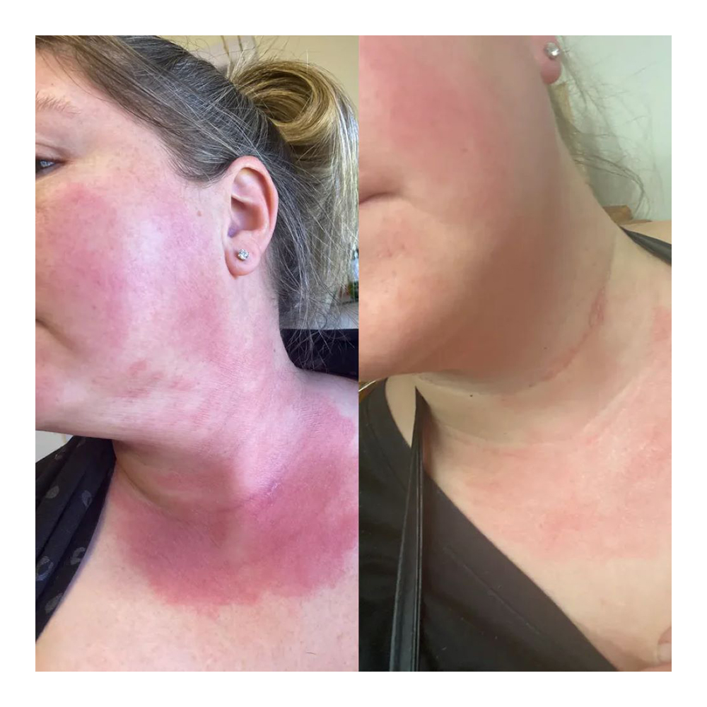 Probiotic Skin Mylck Moisturiser - 30ml