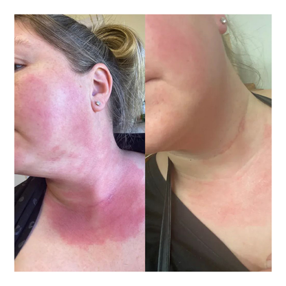 Probiotic Skin Mylck Moisturiser - 30ml