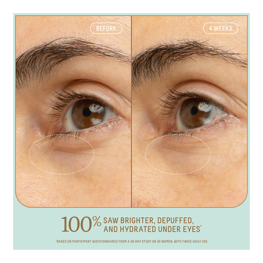 Squalane + 5% Niacinamide Brightening Eye Serum - 15ml