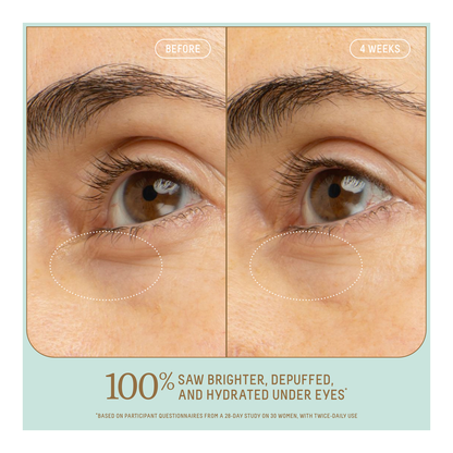 Squalane + 5% Niacinamide Brightening Eye Serum - 15ml