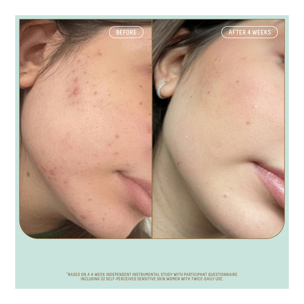 Squalane + Probiotic Moisturizer Pump - 50ml