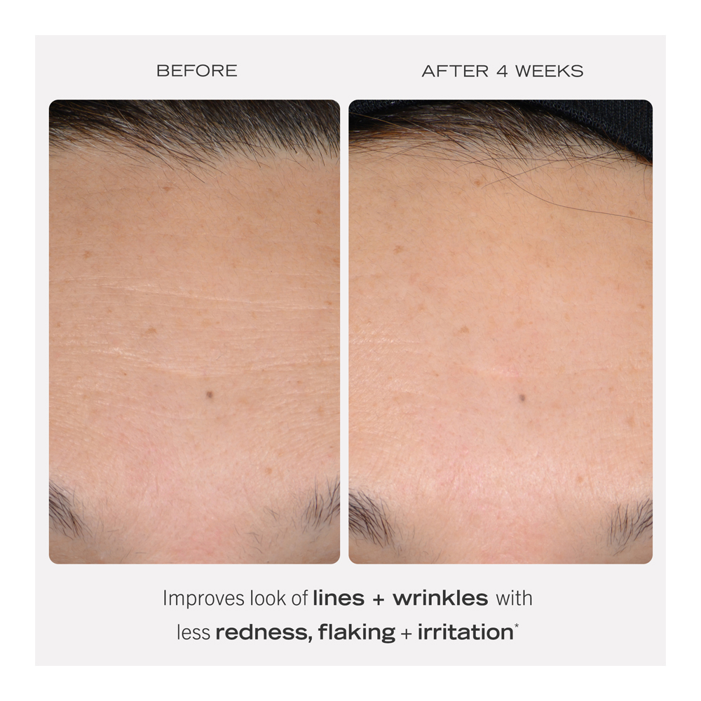 0.3% Retinol Complex Serum - 30ml