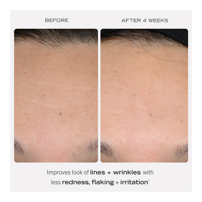 0.3% Retinol Complex Serum - 30ml