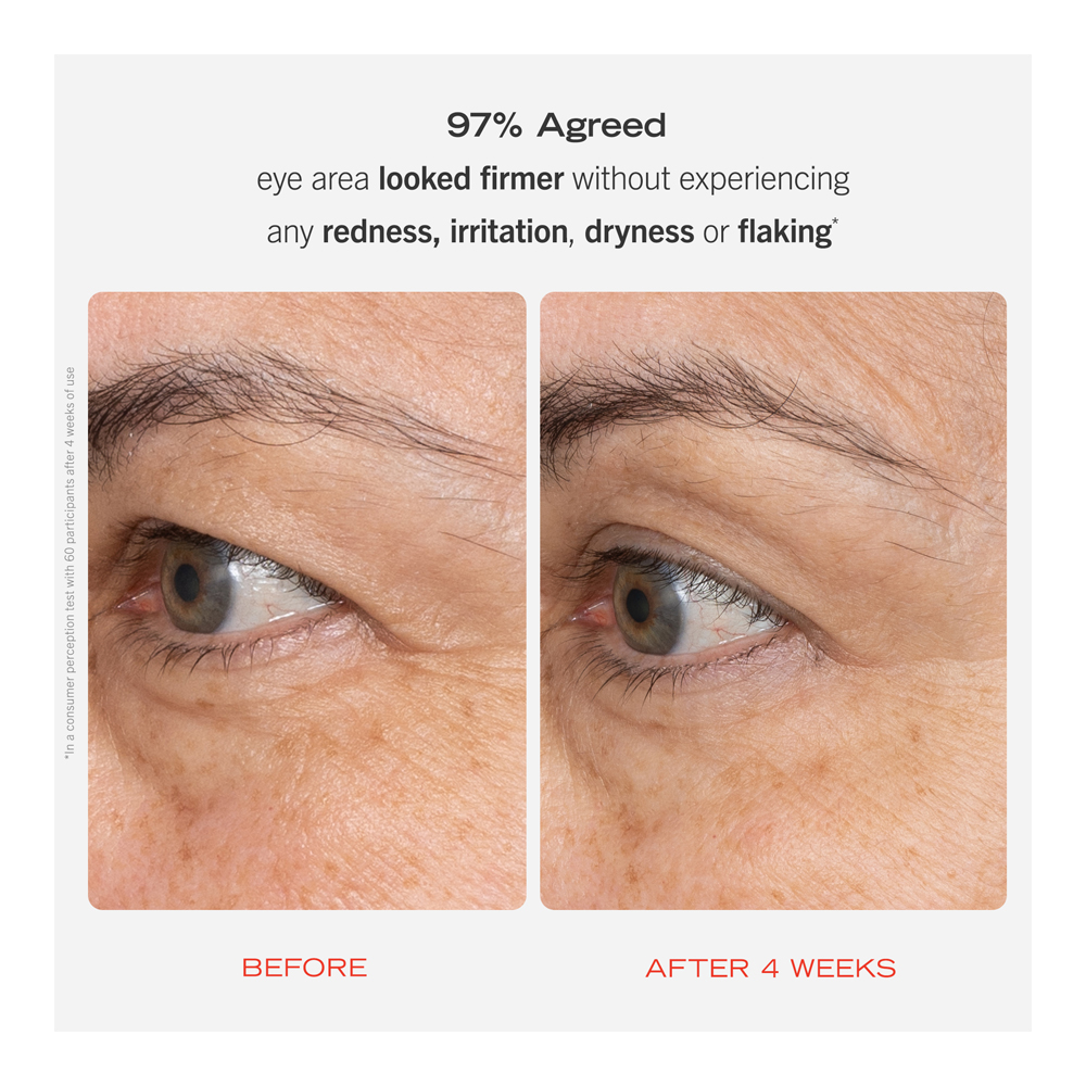 Retinol Eye Cream - 15ml