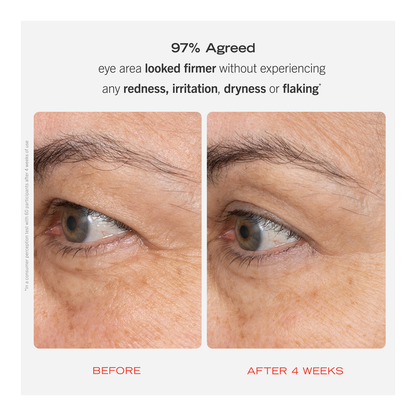 Retinol Eye Cream - 15ml
