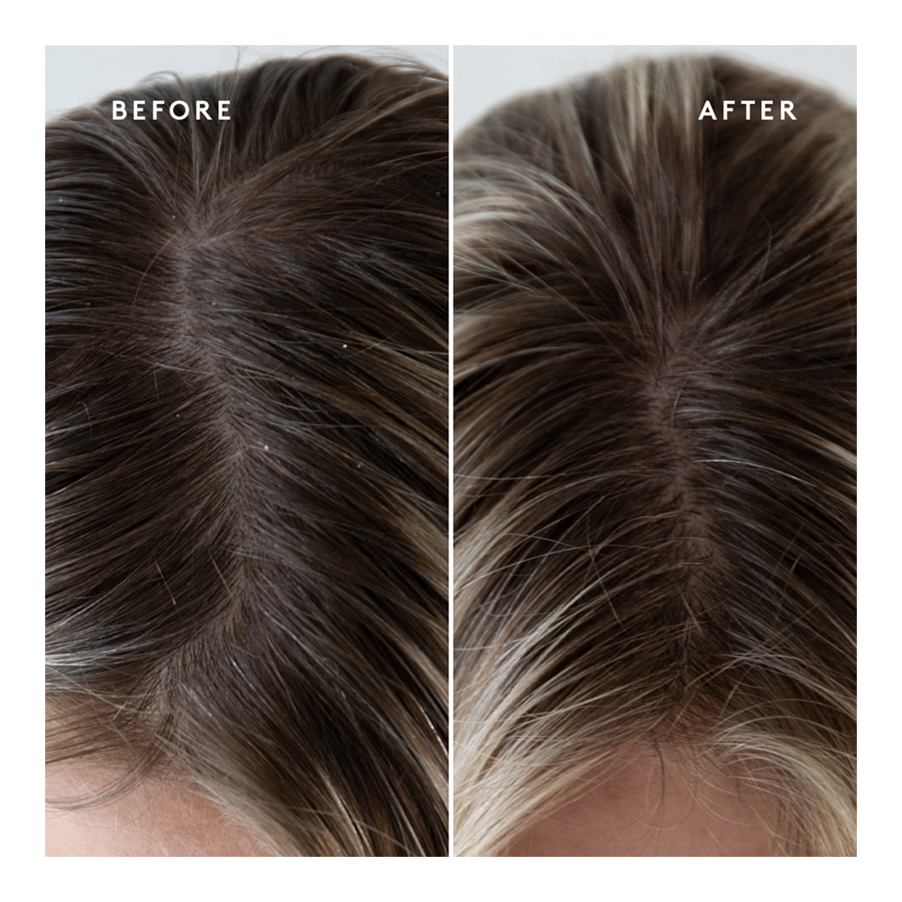 Exfoliating Scalp Treatment - 150ml