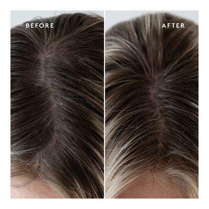 Exfoliating Scalp Treatment - 150ml