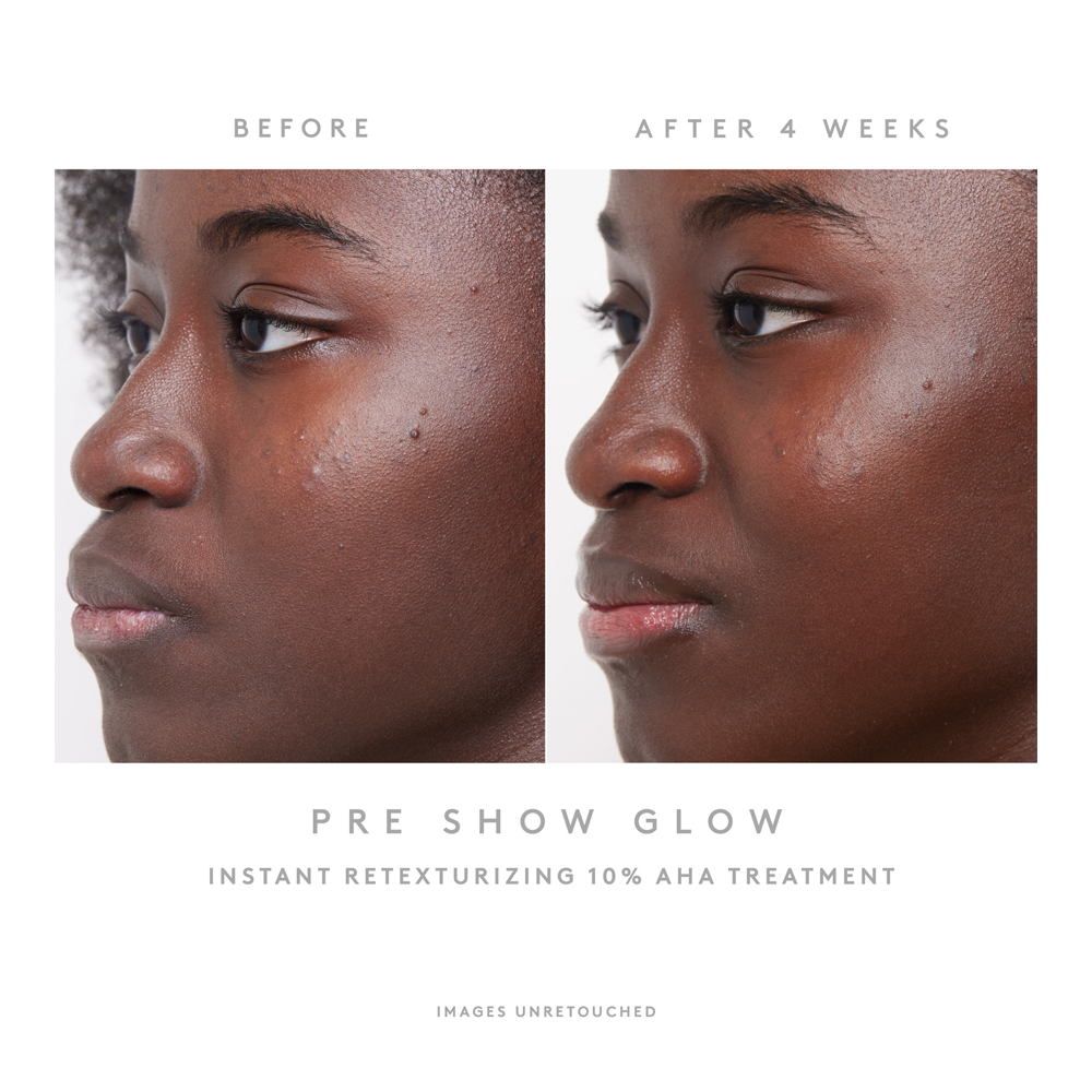Pre-Show Glow Instant Retexturizing 10% AHA Treatment + Reusable Applicator - 30ml