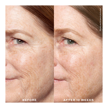 Transform Double Rewind Pro-Grade 0.3% Retinol Serum - 30ml