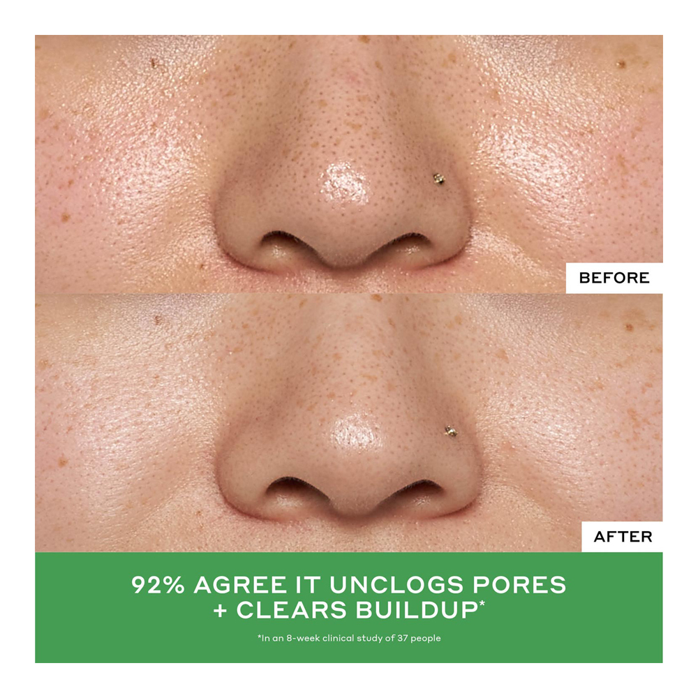 Detox Drops 2% Salicylic Acid Anti-Blemish Toner - 120ml