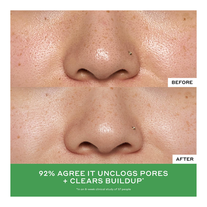 Detox Drops 2% Salicylic Acid Anti-Blemish Toner - 120ml