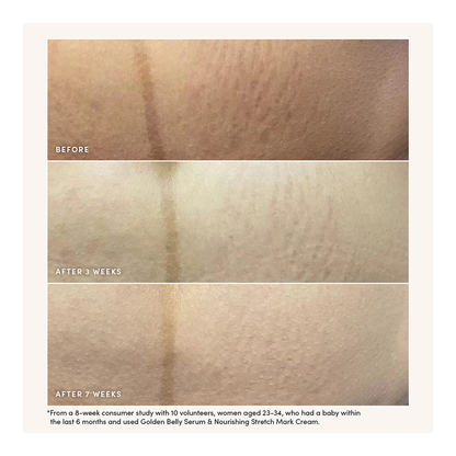 Golden Belly Serum - 50ml